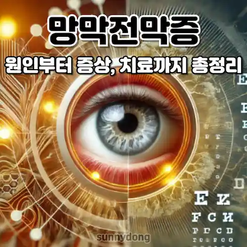 망막전막 원인부터 증상, 치료까지 총정리 썸네일