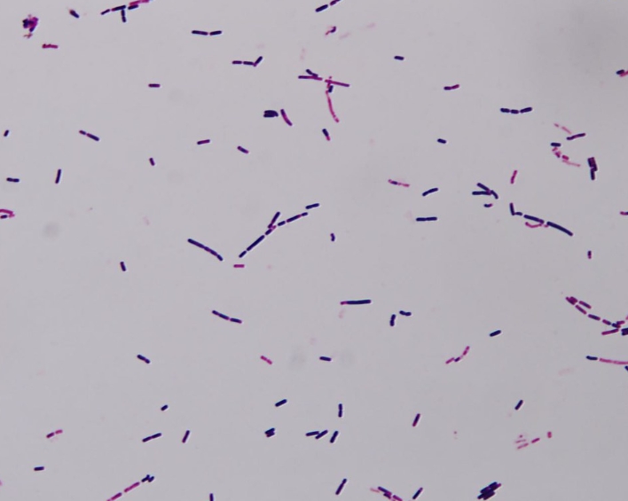 바실러스 세레우스 박테리아