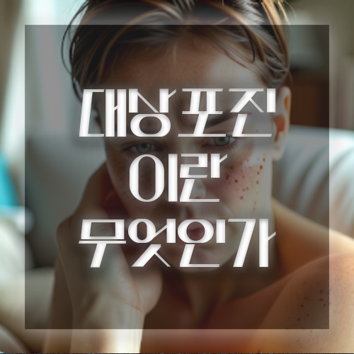 대상포진이란 무엇인가