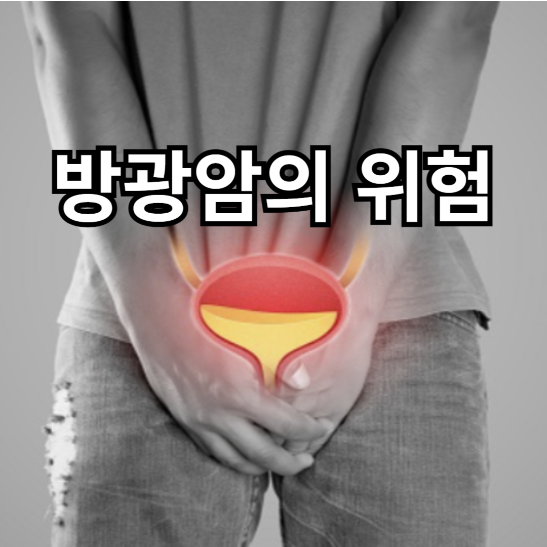  방광암 위협 요인 여러분은 위협에 처해 있나요