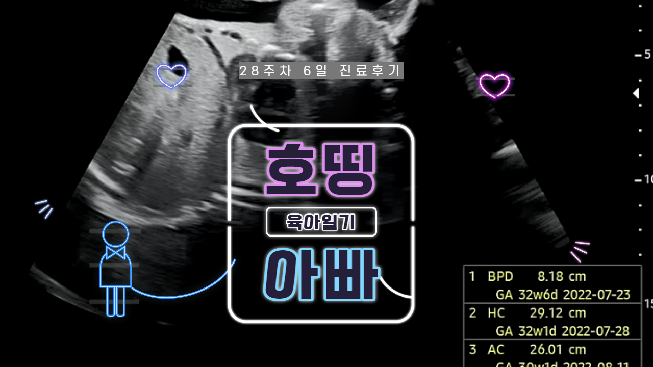  태아 28주차 6일 초음파 진료 후기 (FEAT. 백일해 주사 접종 후기)