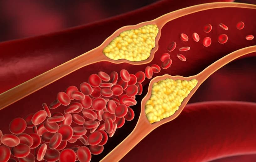  HDL 콜레스테롤 높이는 음식 정리