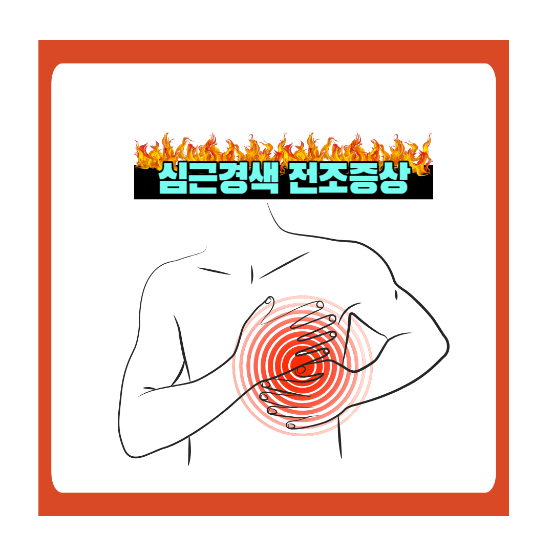  급성 심근경색 전조증상 그 예방과 치료