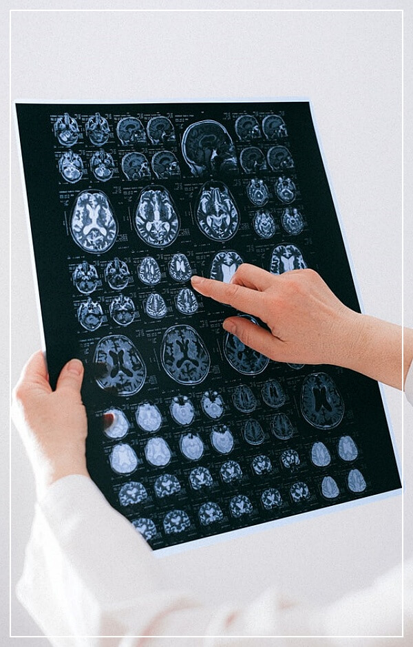 뇌검사-차트