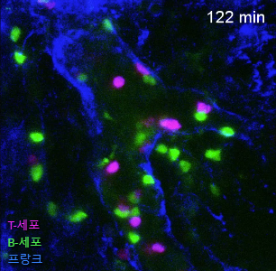 생체현미경으로 본 림프절