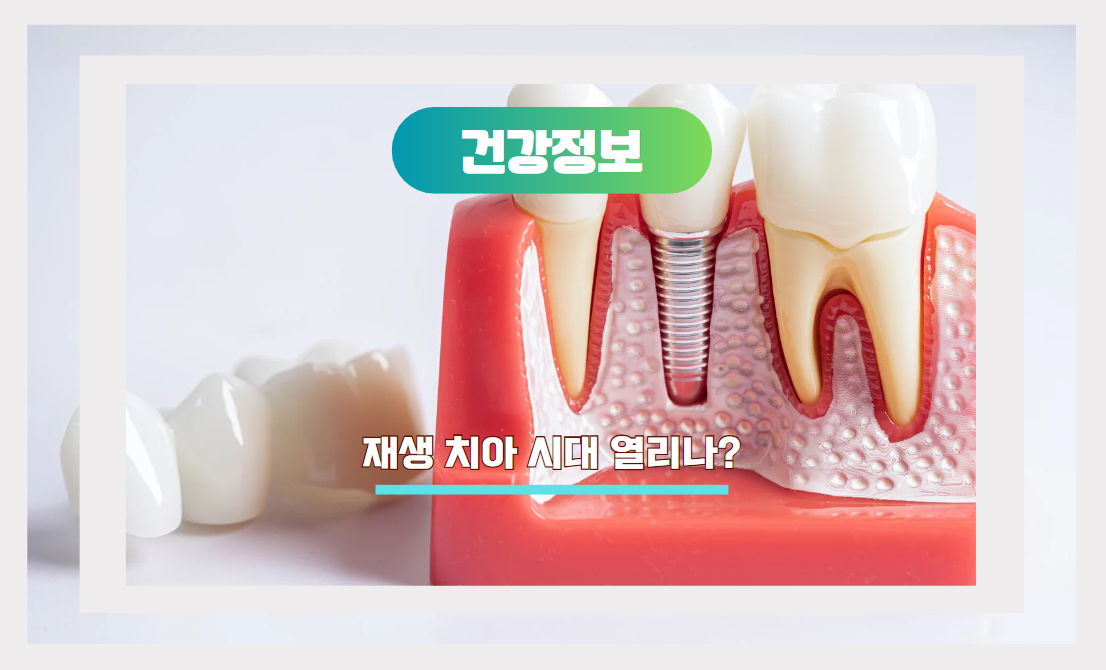 재생치아