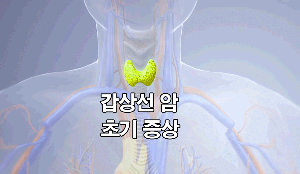  갑상선암 초기 증상 : 좋은 음식