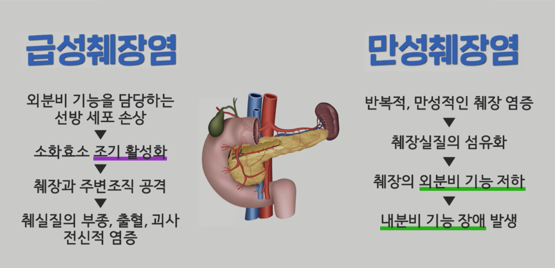 췌장 관련 혈액검사