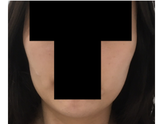 광대 부각.png