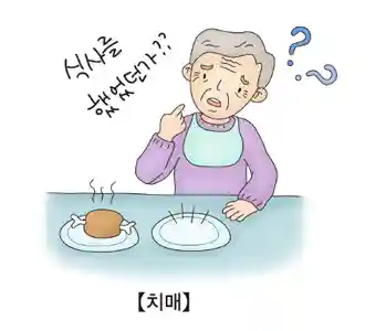 알츠하이머 치매 증상 중 가장 흔한 것이 기억 장애입니다. (출처 : 서울아산병원 건강정보)