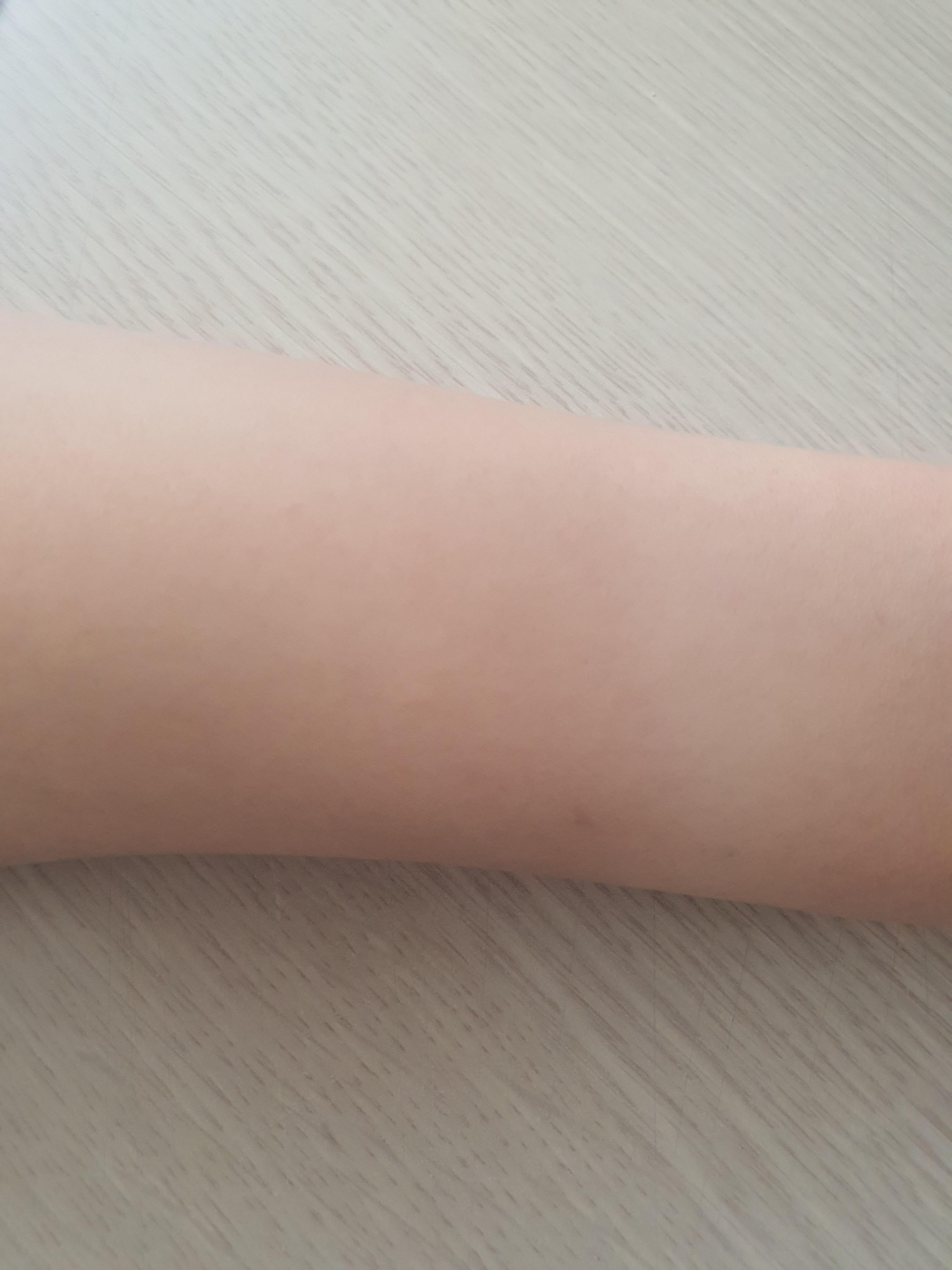  브라질리언 제모 후기 / 8회차 / 제모 비용 / 여름 제모