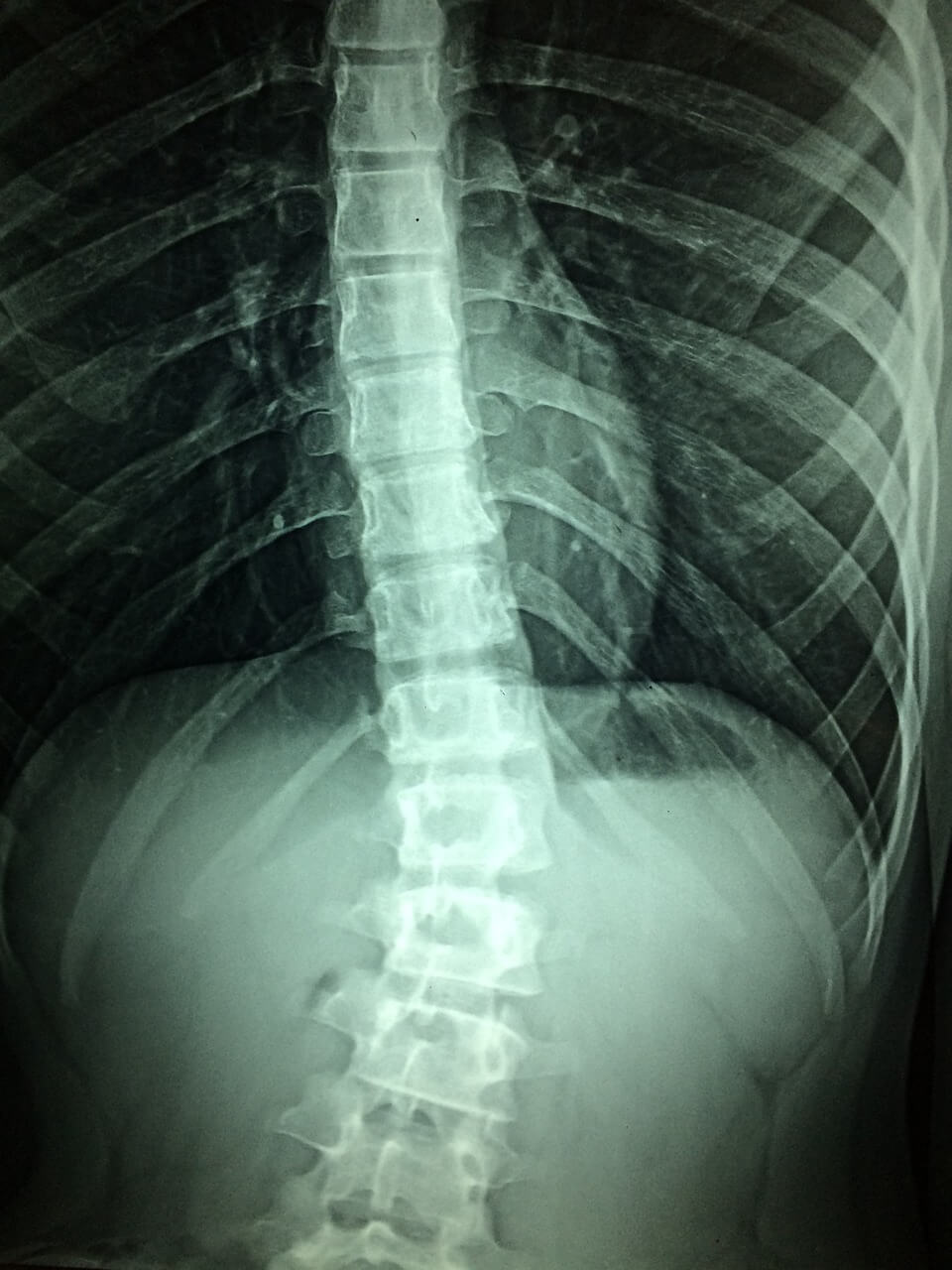 spinal-cord-photo