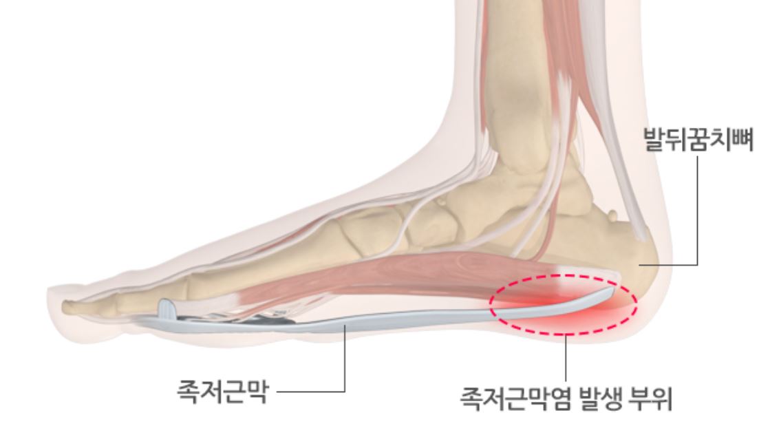 발의 구조를 나타낸 다이어그램