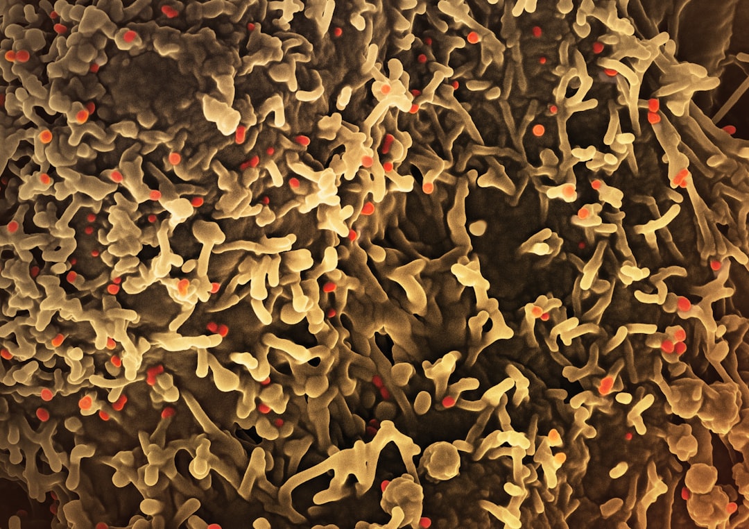 Monkeypox