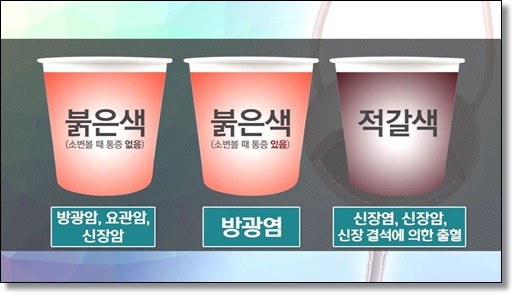 소변 색깔