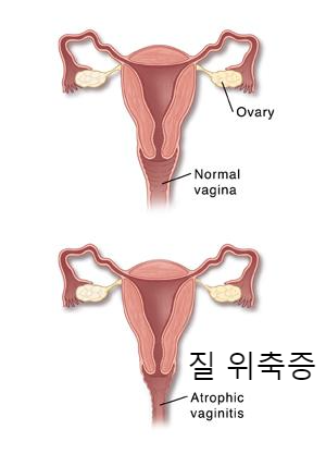 알트태그-변화