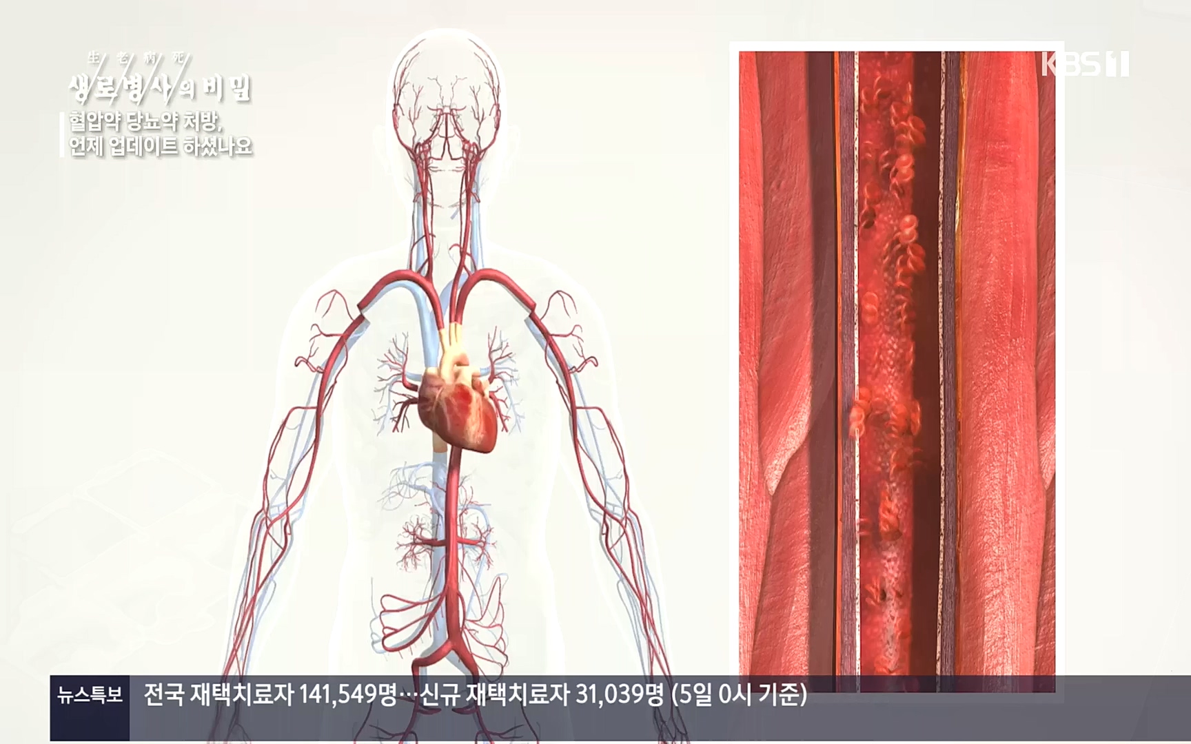 생로병사의 비밀.E838.221005p.H264-F1RST.mp4_20221008_182148.962.jpg
