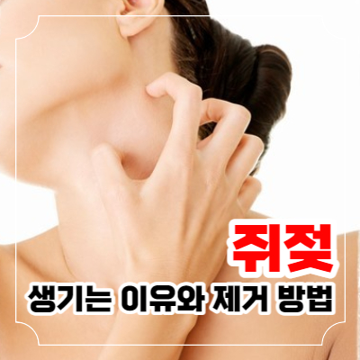 쥐젖 생기는 이유와 제거 방법 사진