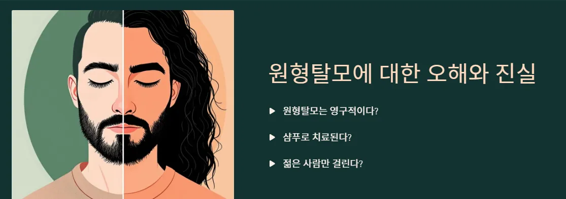 원형탈모-오해와-진실