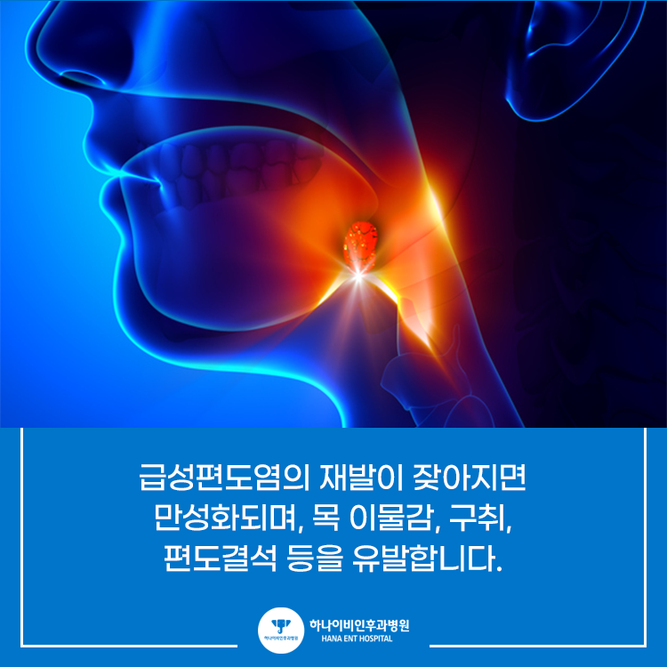 자세히 알아보기! 만성 편도염 편도제거 수술 - a2 자세히 알아보기! 만성 편도염 편도제거 수술 - A2