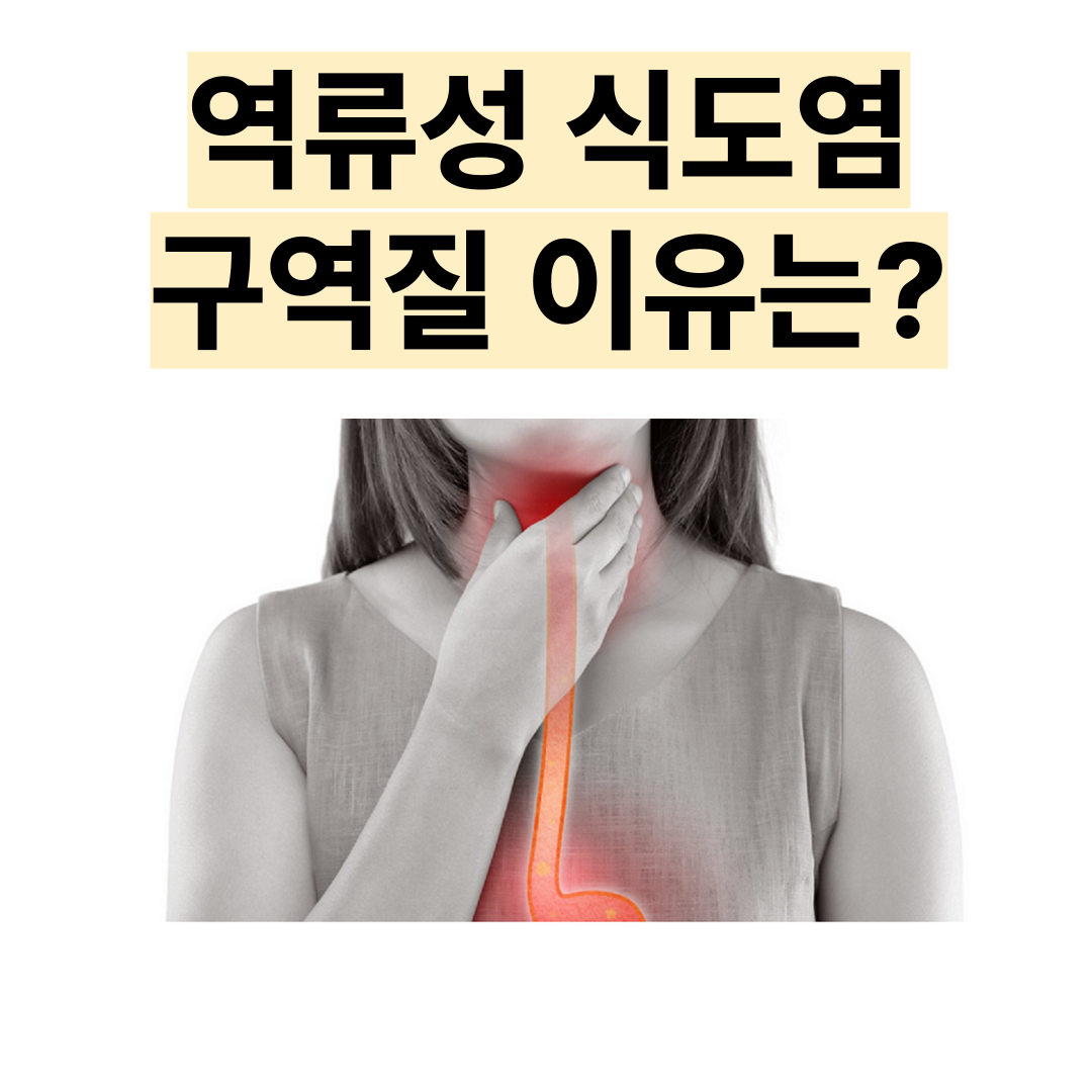 역류성 식도염