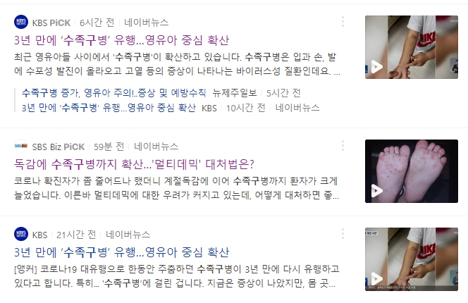 수족구 빠른 치료가 중요한 이유? / 성인 아기 잠복기와 원인 및 전염성