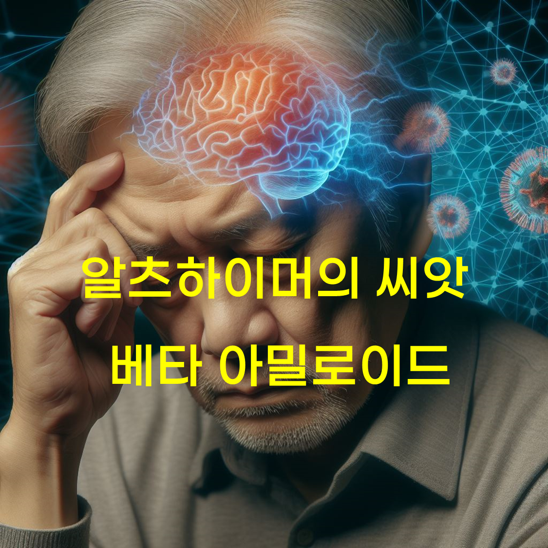 알츠하이머 씨앗 베타아밀로드