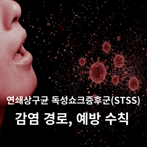 연쇄상구균 독성쇼크증후군(STSS)