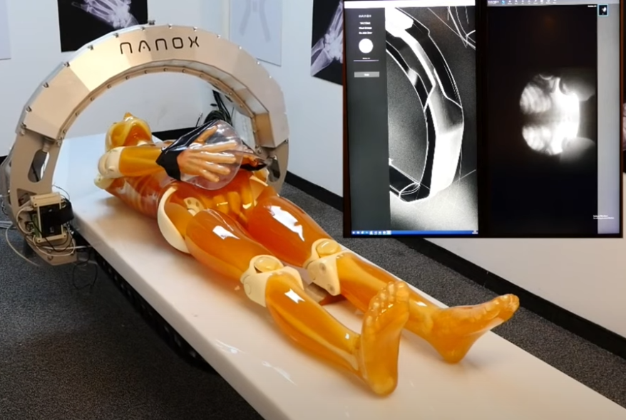  나녹스(Nano-X imaging Ltd) 주식 투자 위험성