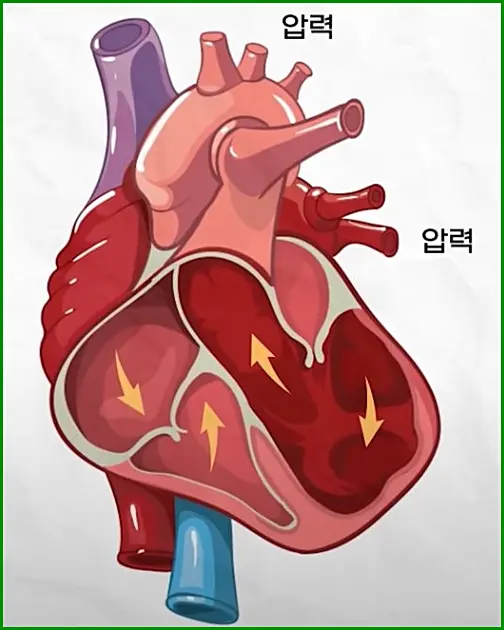 고삼투압성 고혈당 증후군 예방 방법