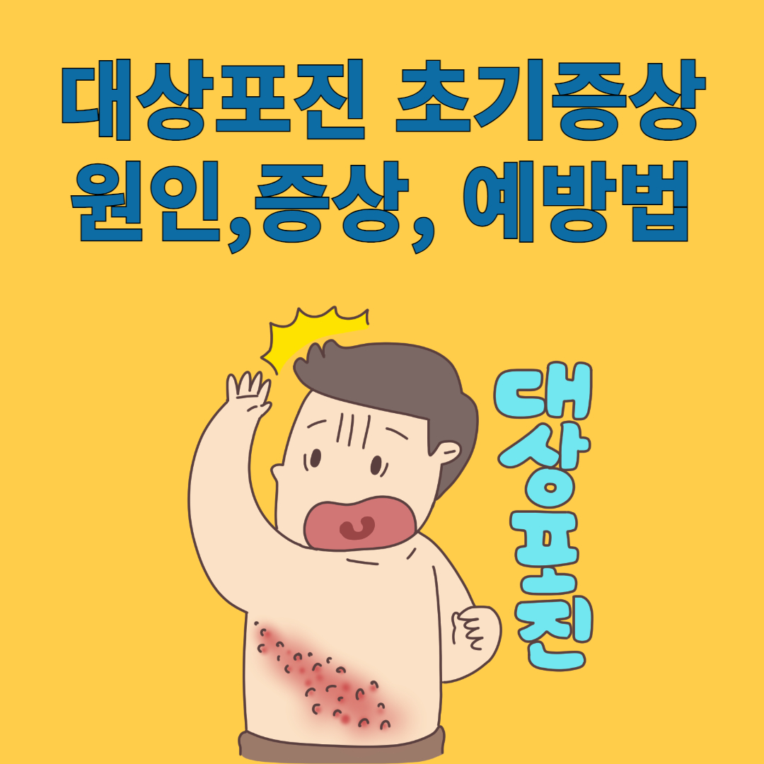 대상포진 초기증상