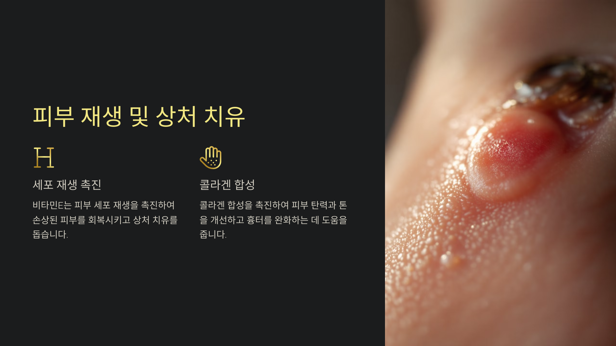 피부 재생 및 상처 치유