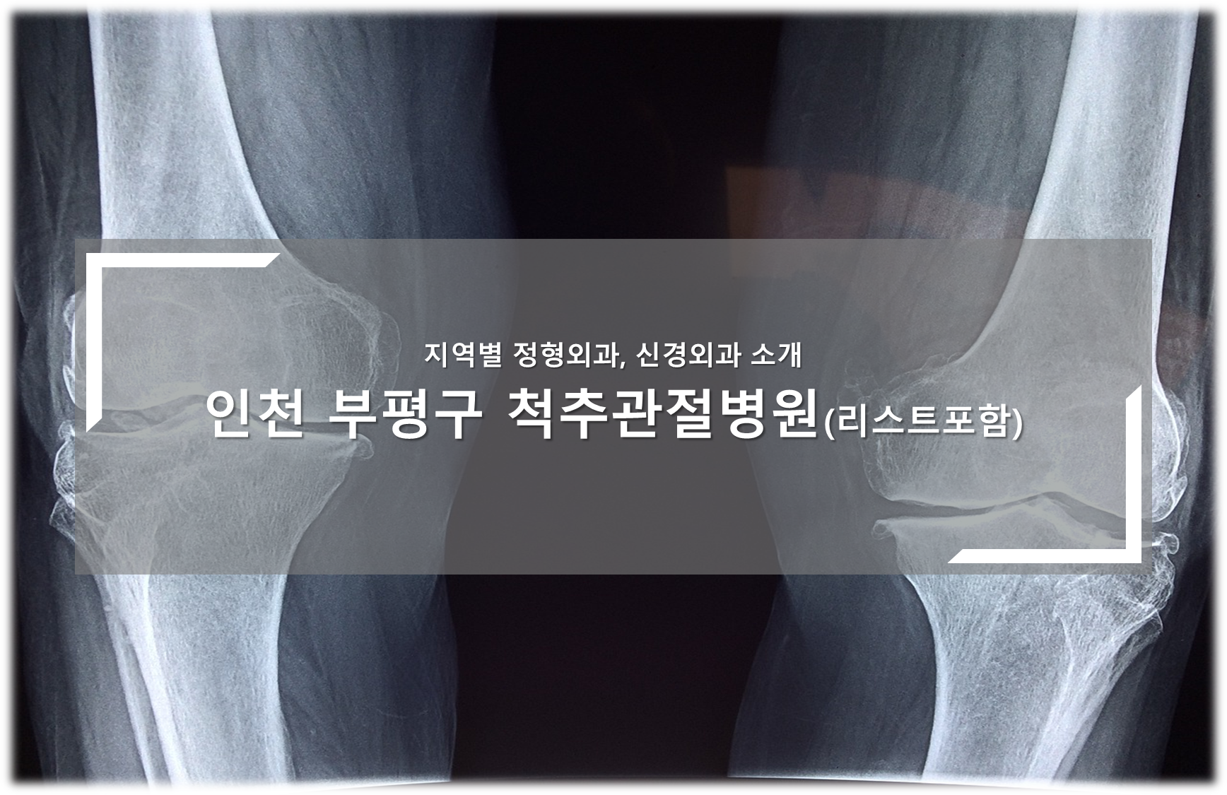 인천 부평구 척추관절병원 안내