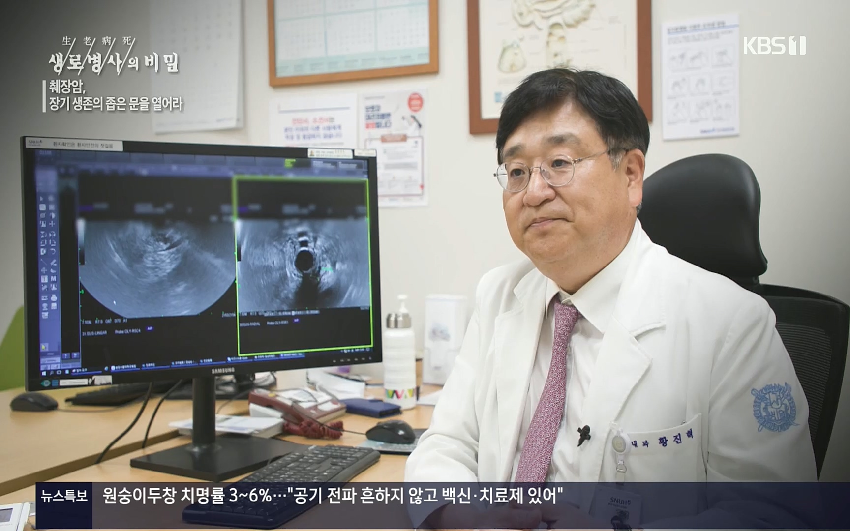 생로병사의 비밀.E823.220622p.H264-F1RST.mp4_20220624_210525.745.jpg