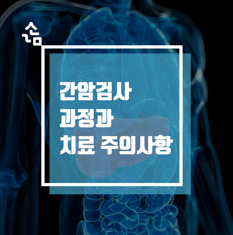 치료시 주의사항은? 간암검사 과정과 4