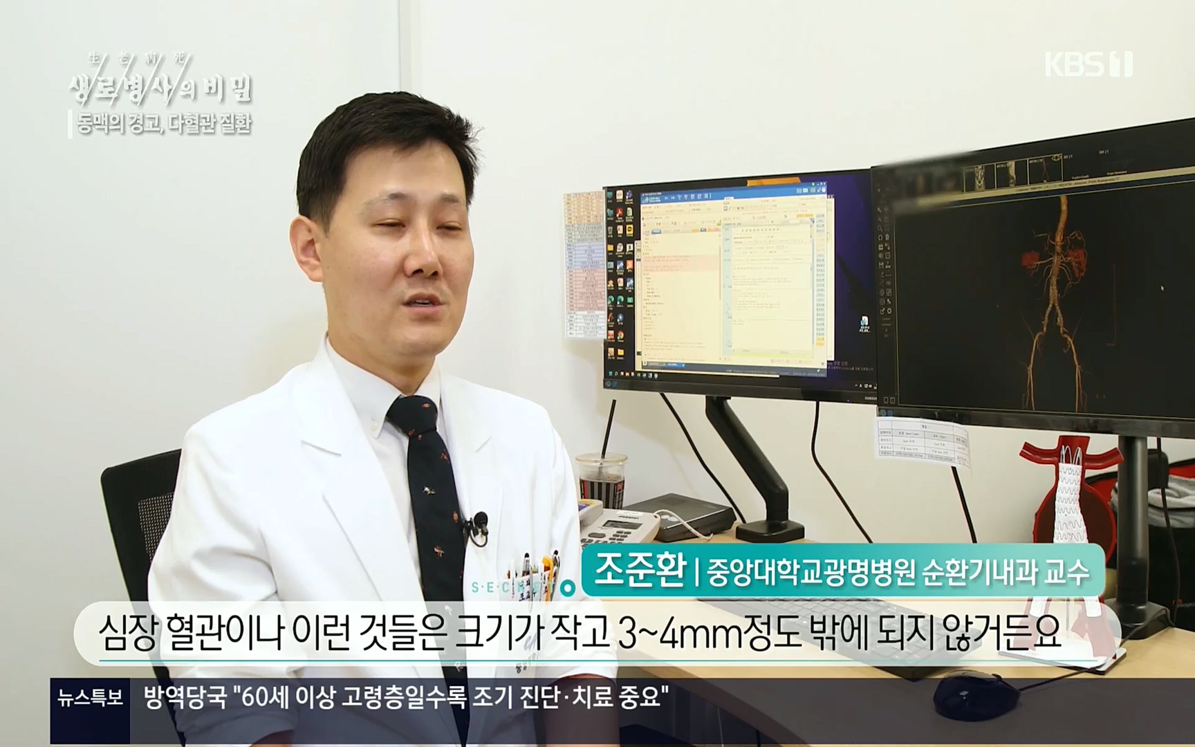 생로병사의 비밀.E831.220817p.H264-F1RST.mp4_20220822_185317.687.jpg