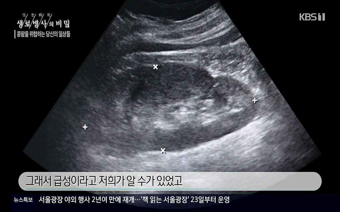생로병사의 비밀.E819.220421p-NEXT.mp4_20220421_191227.673.jpg