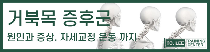 흉곽출구 증후군