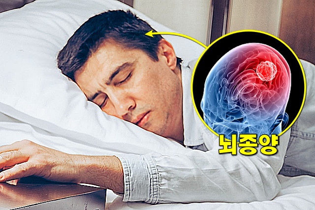 뇌종양 증상 아침에 일어날때 두통 뇌압 출혈 메스꺼움 구토, 건강 팁줌 매일꿀정보