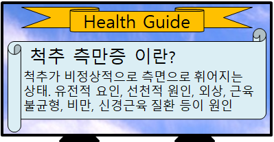 척추 측만증