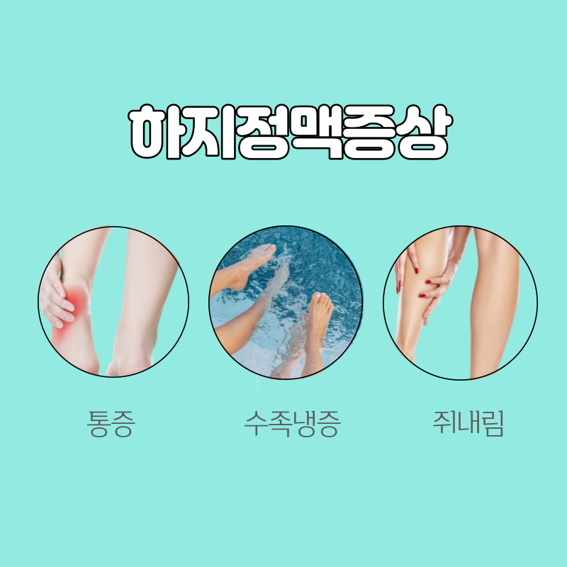 하지정맥류증상