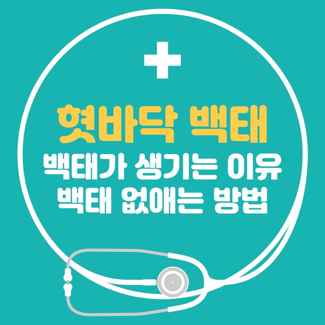  혓바닥 백태 백태가 생기는 이유 백태 없애는 방법 간단정리