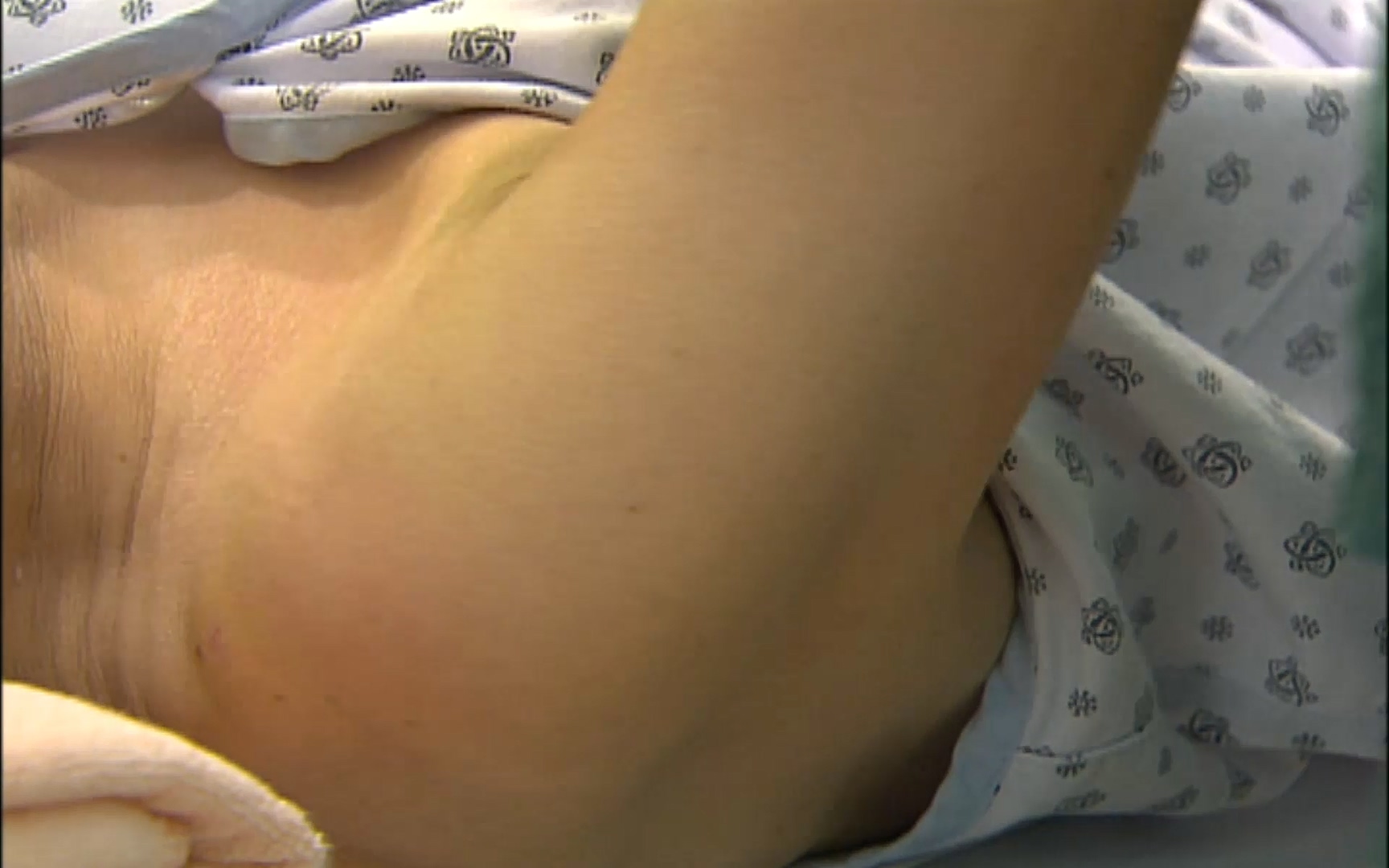 EBS 명의 헬스케어 - TV - 교육의 중심 EBS50대의 공포, 오십견 - 재활의학과 전문의 이강우 교수.mp4_20220913_202320.873.jpg