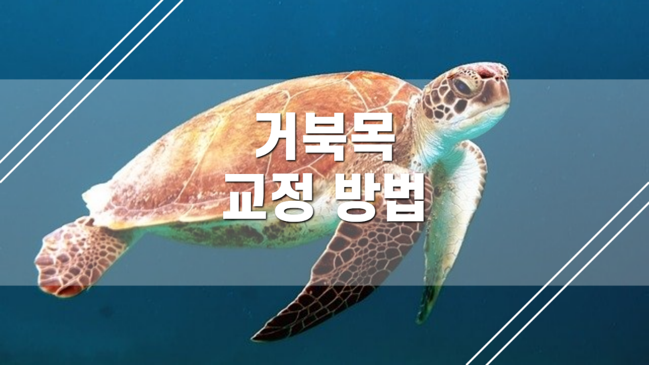  거북목 교정에 좋은 자세 및 스트레칭 방법 공유 드립니다.