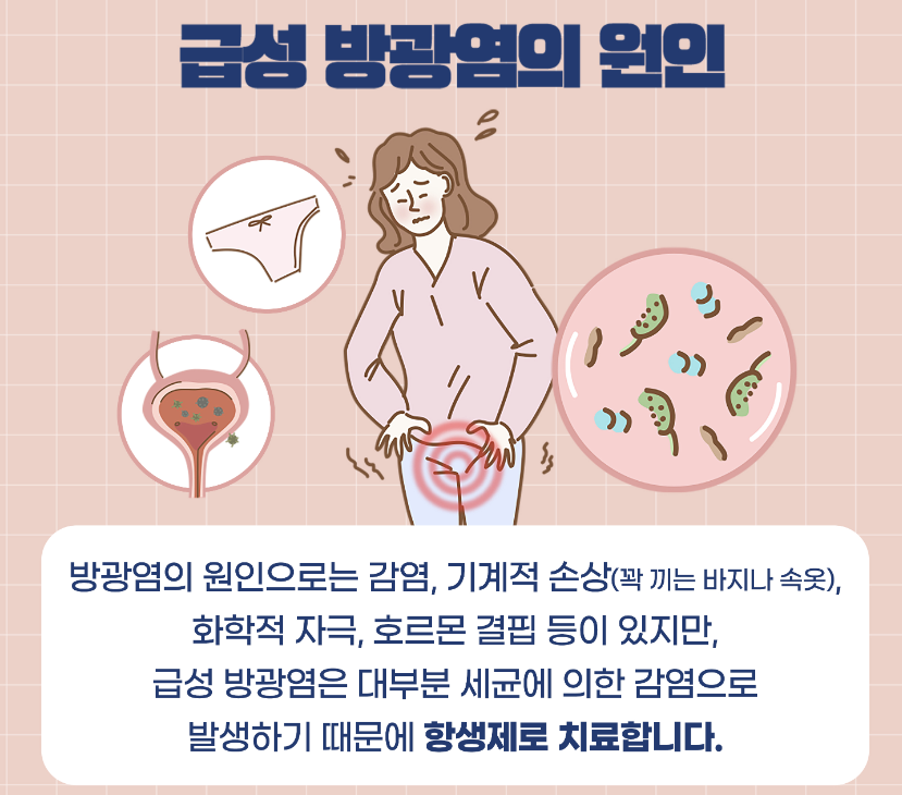 방광염 증상 9가지 총정리 섬네일