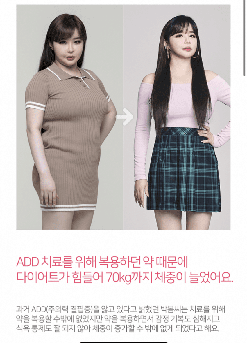  실검 1위 찍은 다이어트 성공한 박봄 보정없는 짤 비포 애프터 비교