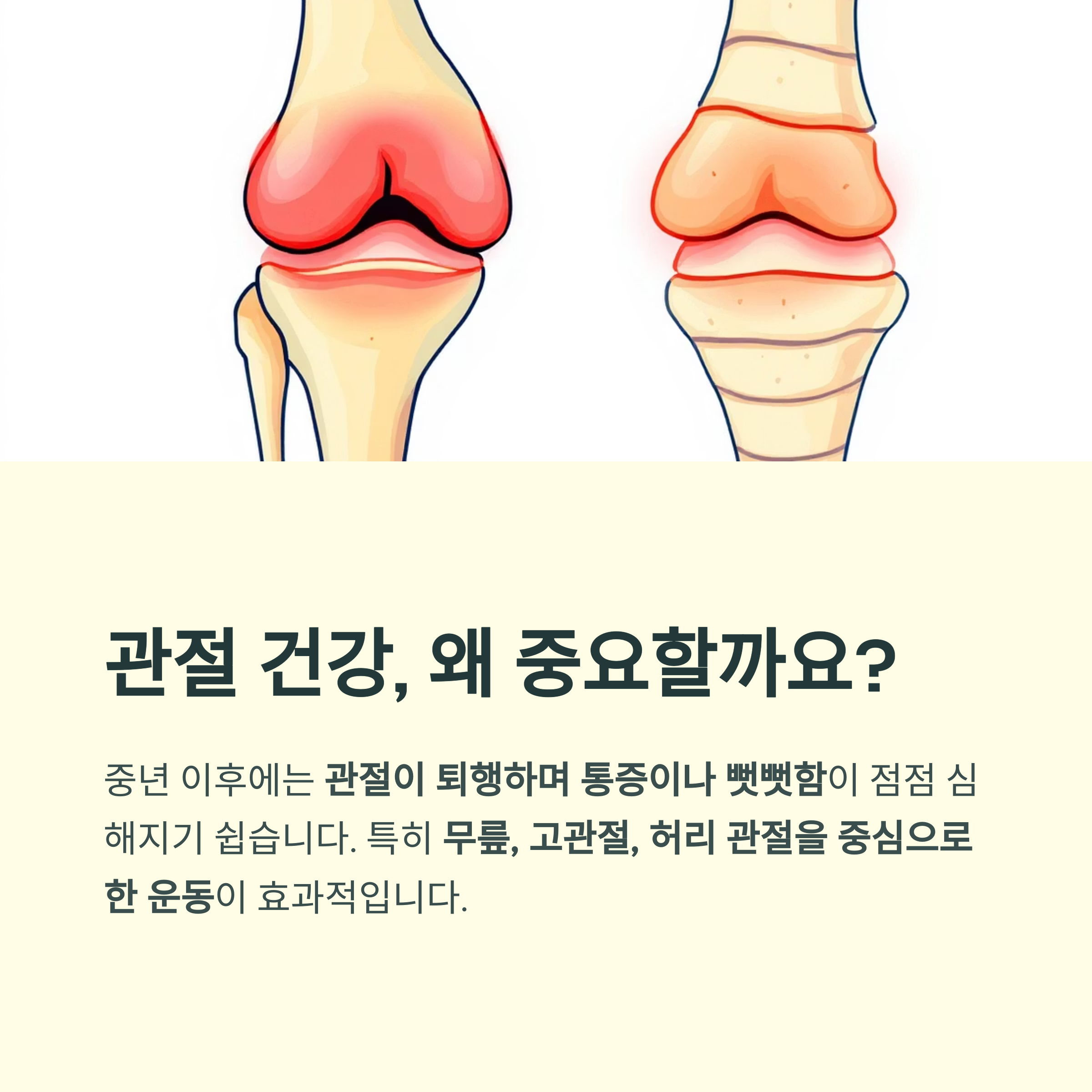 중년 관절 건강을 위한 5가지 데일리 운동 루틴