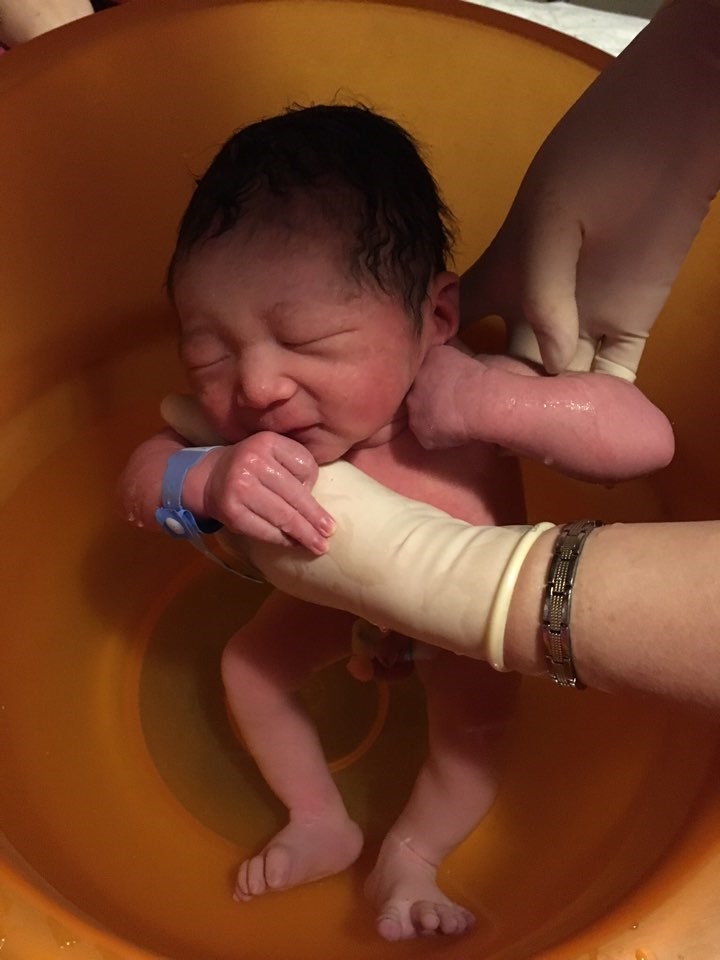 치료 너무 걱정하지 마세요 신생아 황달 원인과 수치, 5