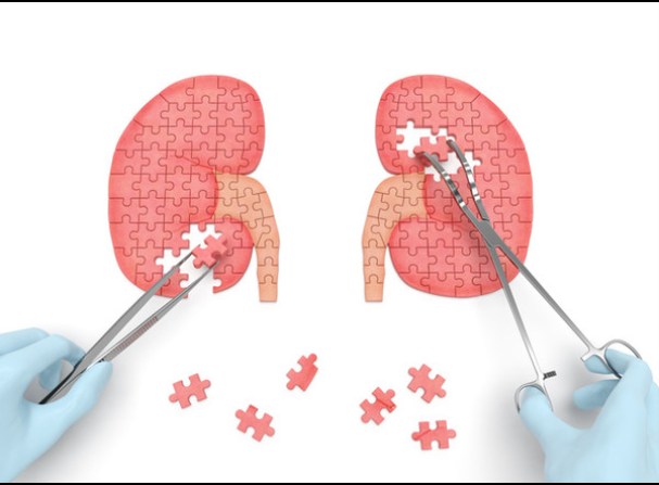 신장이 안좋으면 나타나는 증상 2