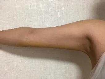 쥬비컷 팔뚝 슬리밍 랩핑 효과 직접 사용 후기와 방법 가격 분석_29